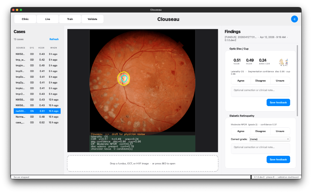 Clouseau clinical interface screenshot